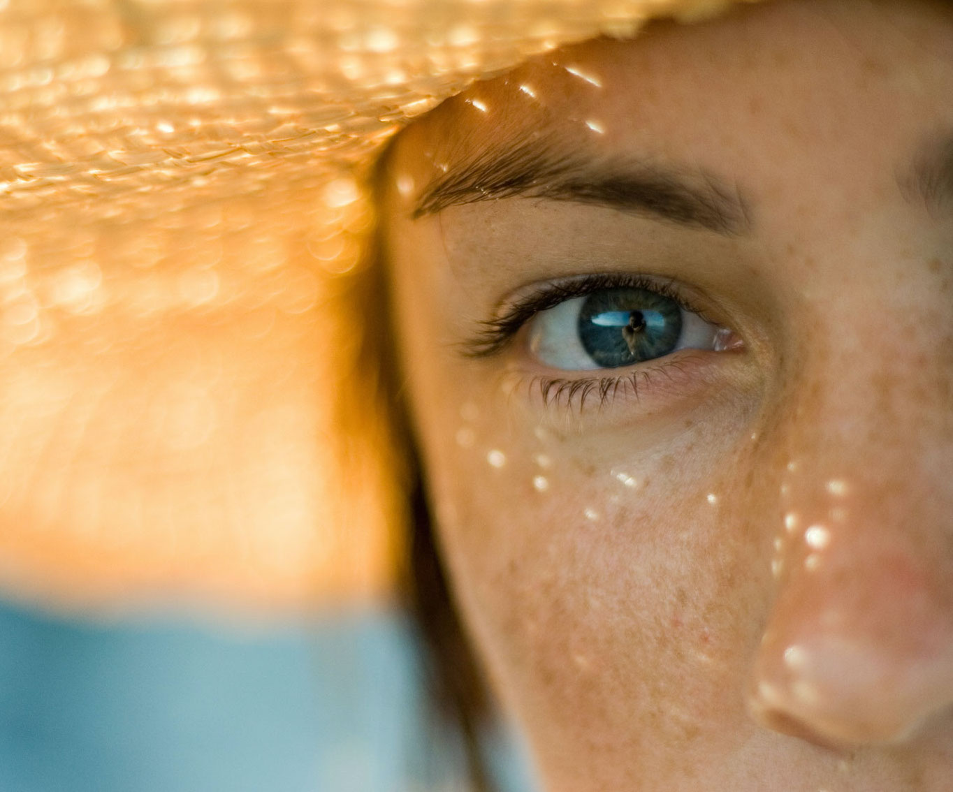 Il Melasma: cause e prevenzione